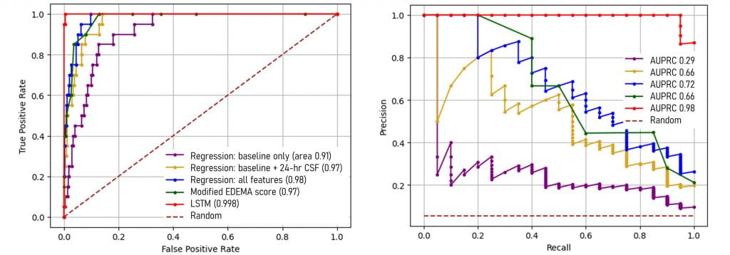 Area under receive-operating-characteristic (left) and precision-recall (right) curves for various machine learning models to predict malignant cerebral edema after stroke.